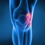 medial-knee-pain